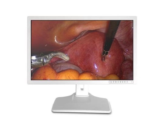 Les accessoires endoscopiques médicaux montrent 32inch