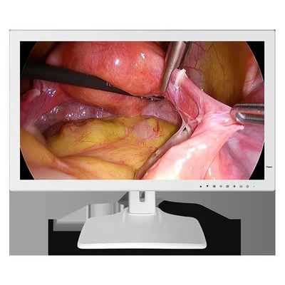 moniteur médical 24inch d'Endoscope de 1980x1200 RGBS