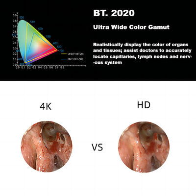 Nouveau 4K ultra HD système médical de caméra d'Endoscope du DEC 3840A pour la laparoscopie